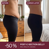 Sculpt Brief™ · Postpartum Support